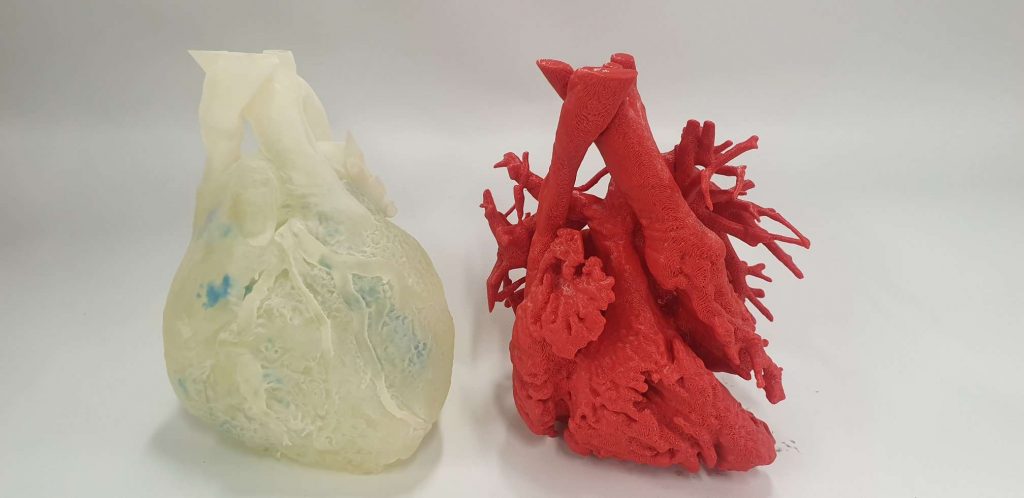 3D生命打印技术已应用于一系列医疗应用，包括模拟手术的软打印模型(如图)。照片通过3D Lifeprint。