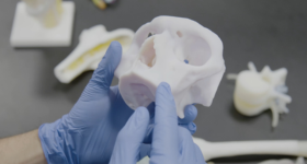 Anatomic 3D-printed models allow medical staff to practice and plan for surgeries. Image via Stratasys.